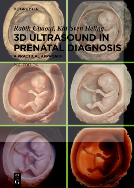 3D Ultrasound in Prenatal Diagnosis: A Practical Approach