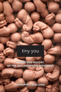 Tiny You: Eine westliche Geschichte der Anti-Abtreibungsbewegung