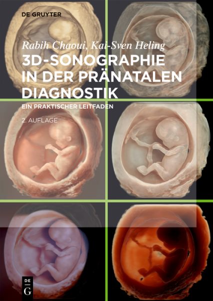 3d-Sonographie in Der Pränatalen Diagnostik: Ein Praktischer Leitfaden (2.Erweiterte Und Aktualisierte Auflage)