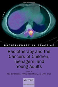 Radiotherapy and the Cancers of Children, Teenagers and Young Adults